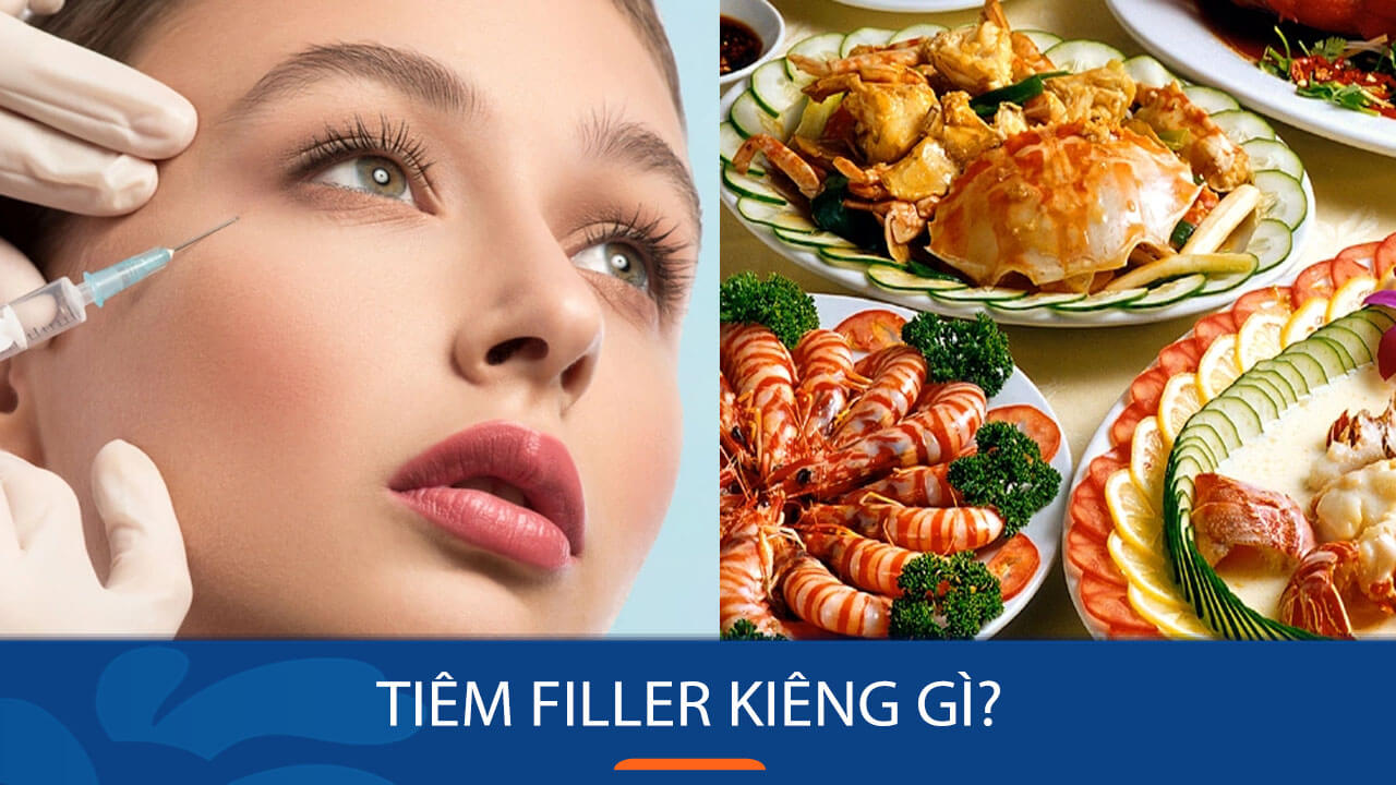 Tiêm filler kiêng gì để đẹp lâu an toàn Hướng dẫn chi tiết từ A đến Z