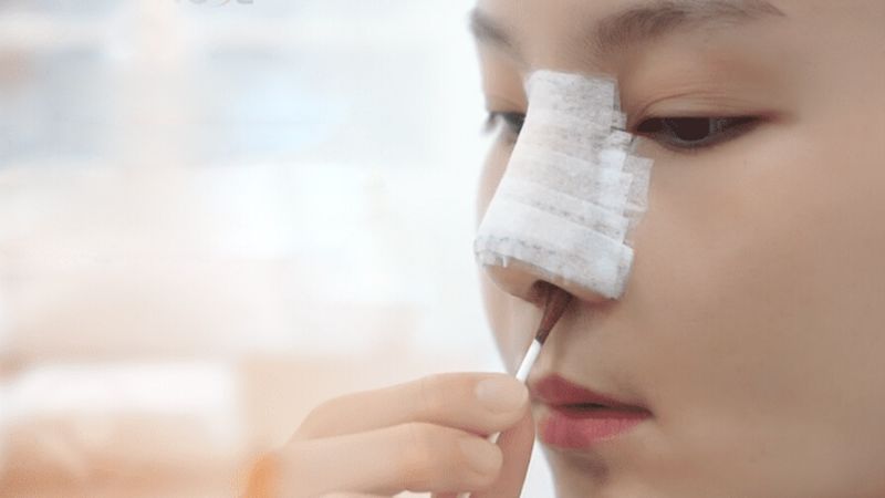 Vệ sinh mũi sạch sẽ với bông tăm thấm vào nước muối sinh lí và lau nhẹ nhàng