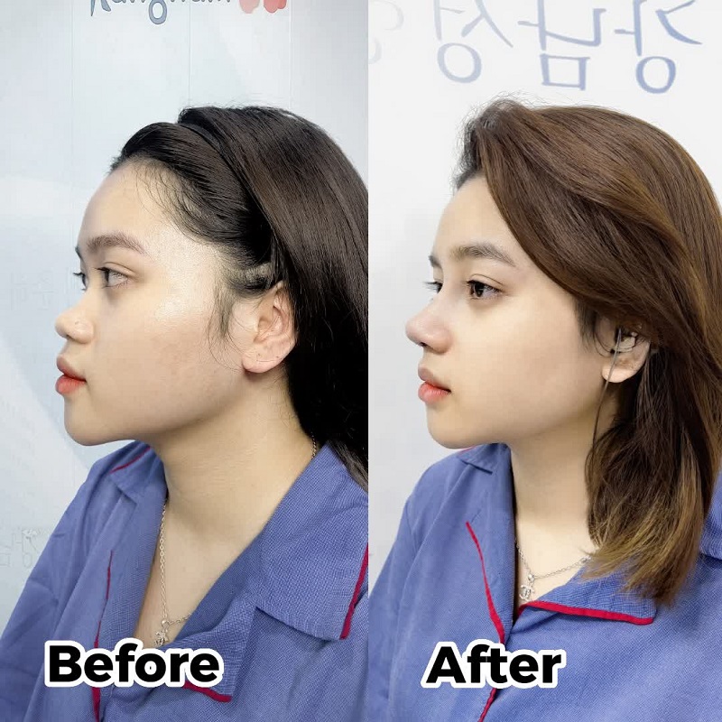 Đầu mũi gợi cảm hình giọt nước