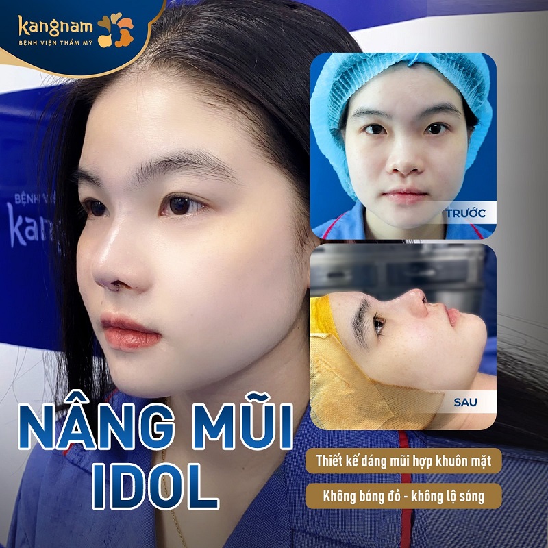 Tạo dáng mũi cao, chuẩn tỷ lệ vàng