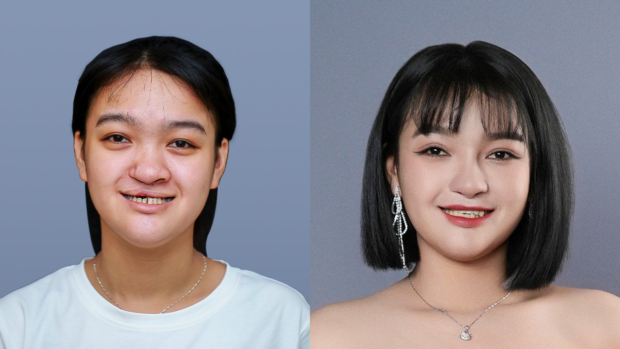 Hành trình Lột Xác đã trải qua 6 mùa, thu hút sự tham gia của đông đảo các thí sinh