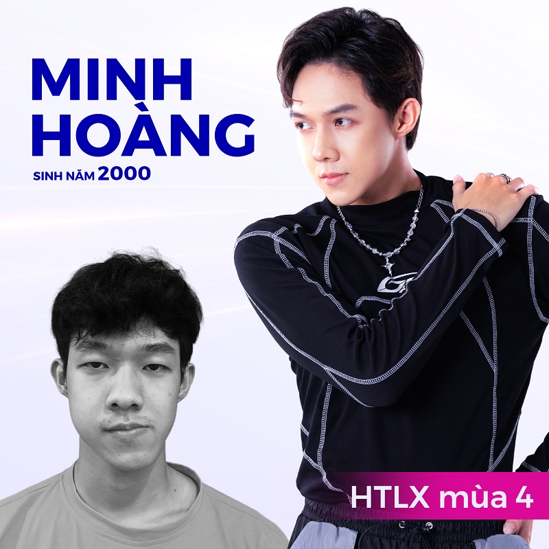 Trần Minh Hoàng sau khi được phẫu thuật thẩm mỹ miễn phí đã có sự nghiệp phát triển hơn