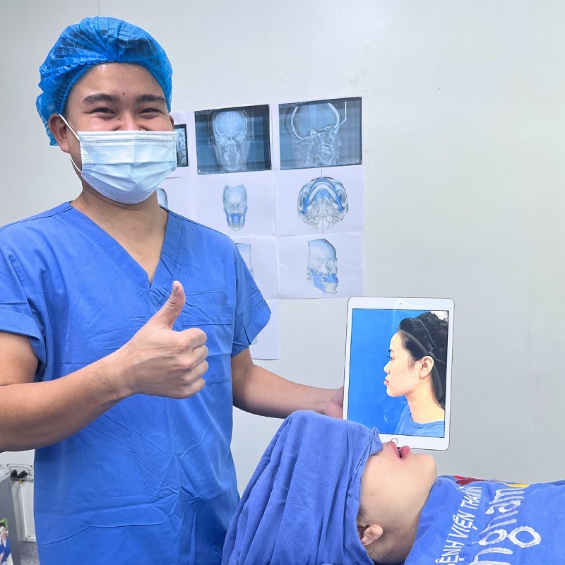 Mặt dài do xương thì cần phẫu thuật chỉnh hàm
