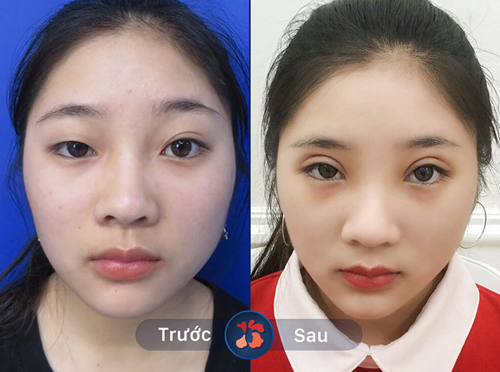 Ms.Thu - Nhờ có đôi mắt to tròn, chị Thu có thể thoải mái trang điểm mà không lo bị nhỏ nhắn