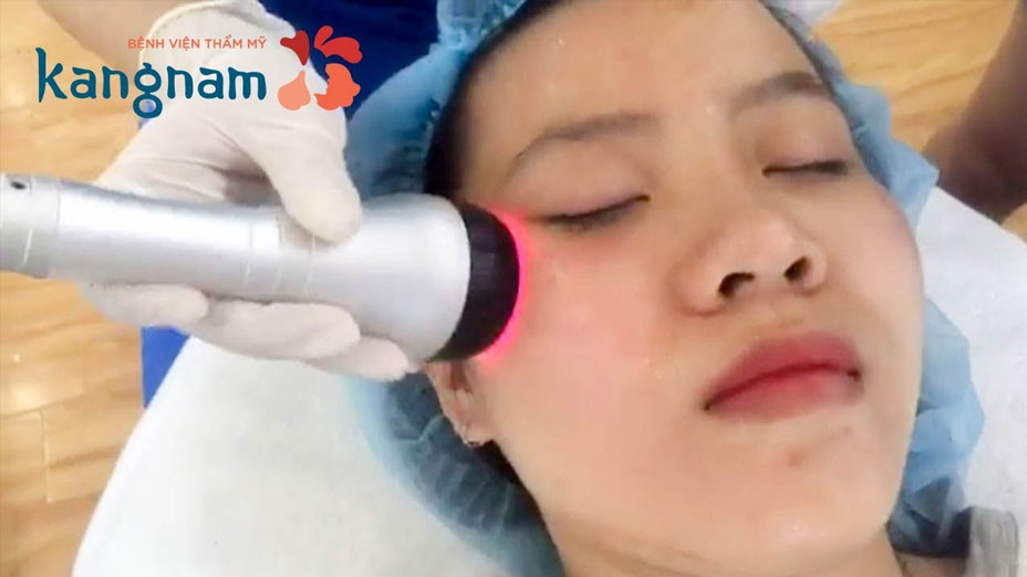 Công nghệ trị nám Laser Toning kết hợp với tinh chất điện di C được áp dụng độc quyền tại Bệnh viện thẩm mỹ Kangnam