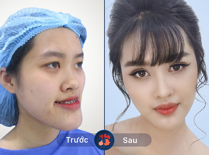 Ms.Trần Thu Nga - Gương mặt trông rất cân đối và tự nhiên