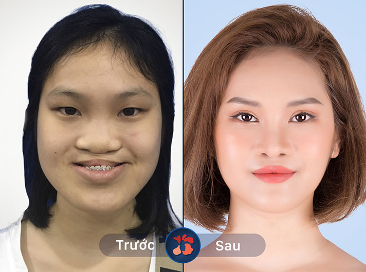 Ms.Phạm Thanh Hương - Khuôn mặt thanh thoát và ưa nhìn hơn