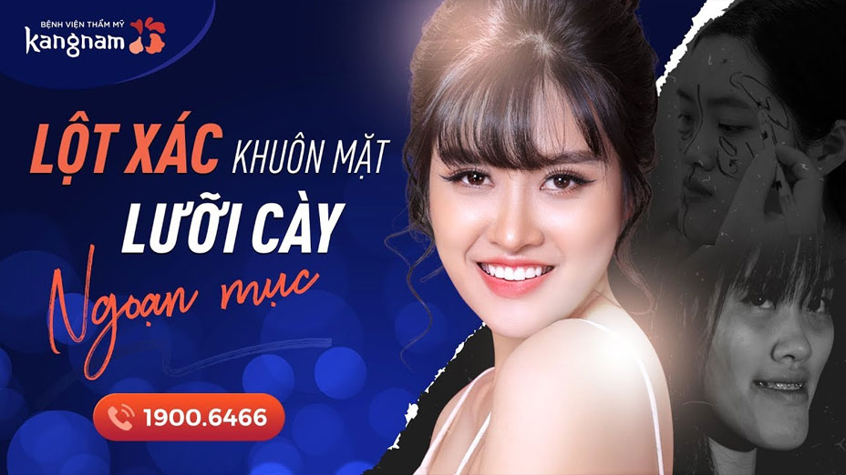 Hotgirl Học viện Cảnh Sát - Thoát mác Mặt Rắn sau 30 ngày