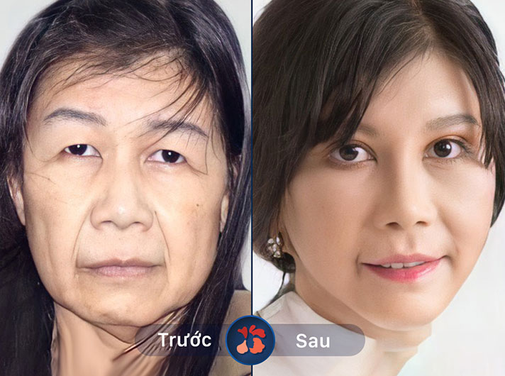 Ms.Phương Thảo - Liệu trình căng da này thực sự hiệu quả, khách hàng sẽ quay lại lần nữa.