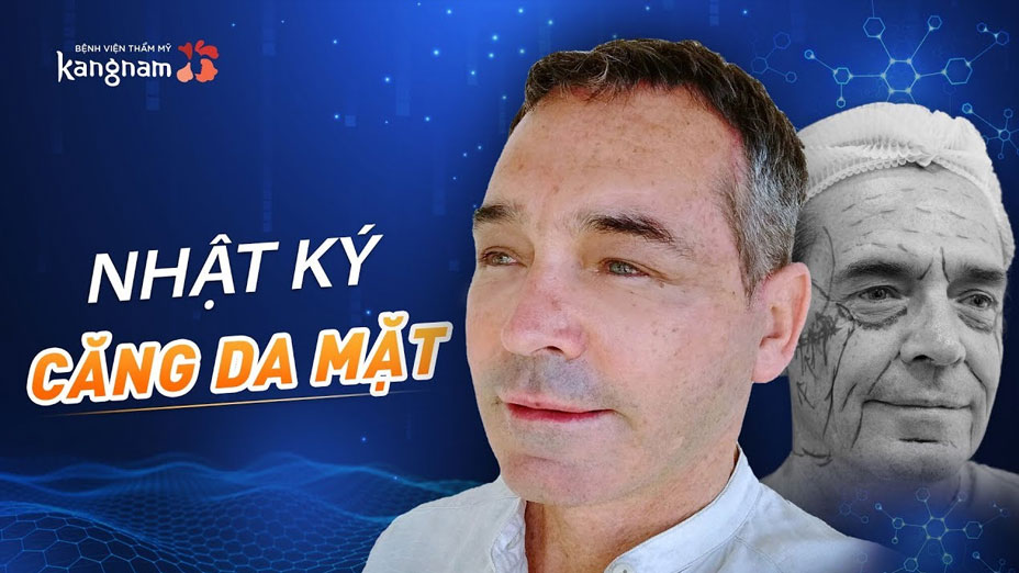 Nhật kí căng da của nam KH ngoại quốc