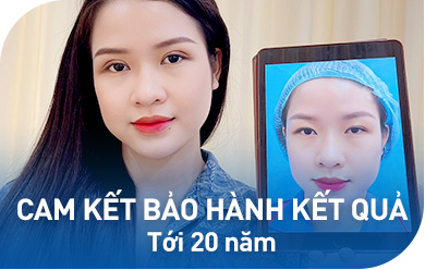 Giữ kết quả bền đẹp