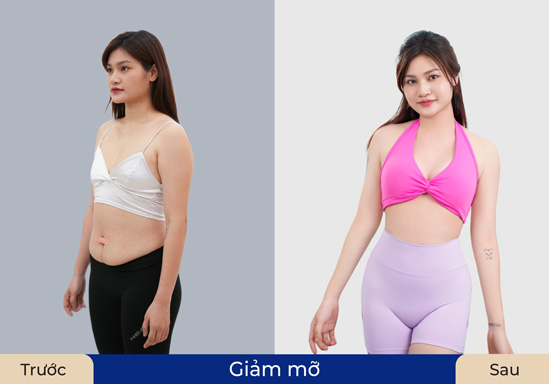 Khách hàng tự tin khoe vóc dáng sau khi sử dụng dịch vụ giảm mỡ