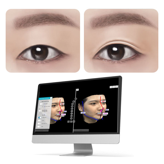 Xem Trước Kết Quả 3D