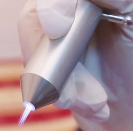 CHIẾU TIA PLASMA LẠNH