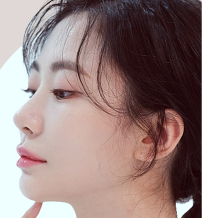 Khắc Phục Mũi Hỏng