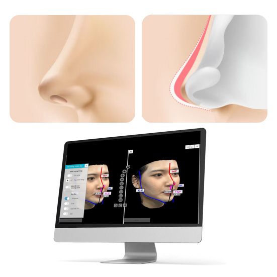 CHO PHÉP XEM TRƯỚC KẾT QUẢ 3D