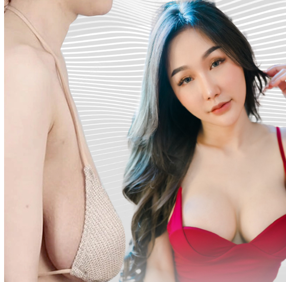 TREO NGỰC SA TRỄ