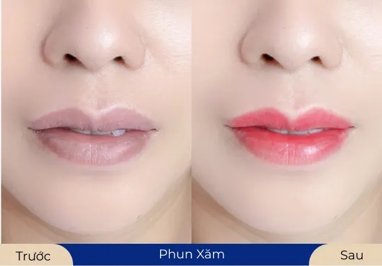 Công nghệ cung cấp collagen giúp đôi môi trở nên căng bóng