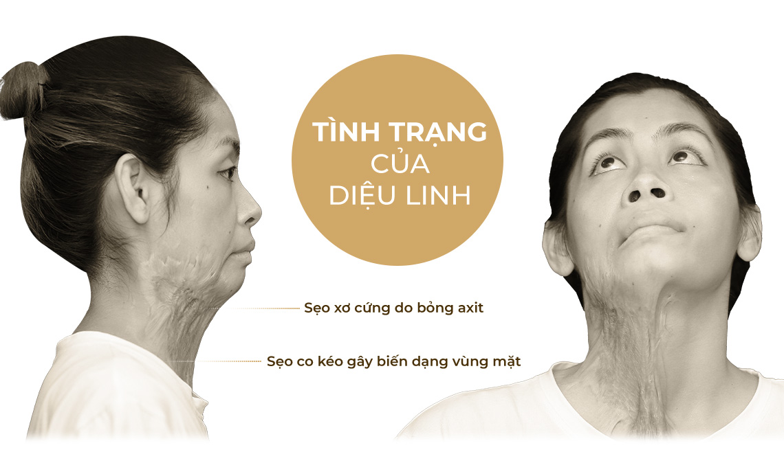 Tình trạng của Diệu Linh