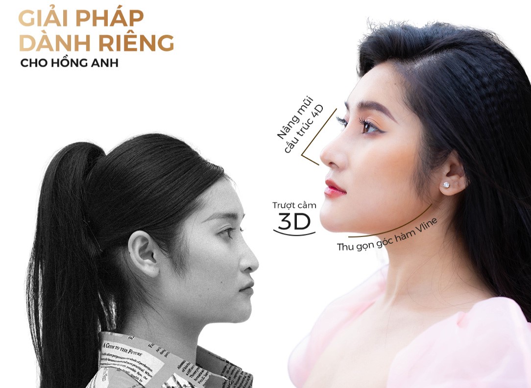 Giải pháp dành riêng cho Hồng Anh