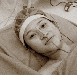 KIỂM TRA LẠI SỨC KHỎE TRƯỚC KHI PHẪU THUẬT