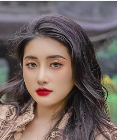 Hình ảnh khác biệt của cô nàng so với trước khi nâng mũi thẩm mỹ tại Kangnam
