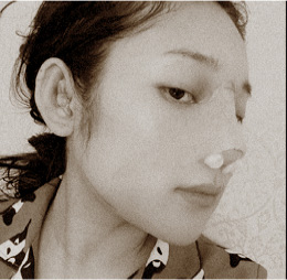 PHẪU THUẬT THU GỌN GÓC HÀM, TRƯỢT CẰM, NÂNG MŨI VÀ CHĂM SÓC HẬU PHẪU