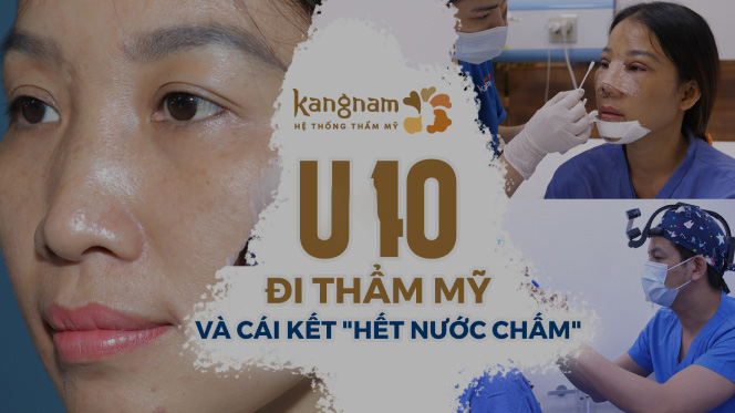 U40 đi thẩm mỹ và cái kết hết nước chấm