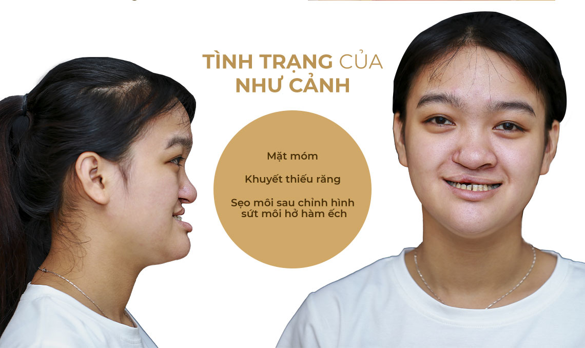 tình trạng của Như Cảnh