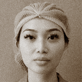 BÁC SĨ TRƯỞNG KHOA TRỰC TIẾP THỰC HIỆN