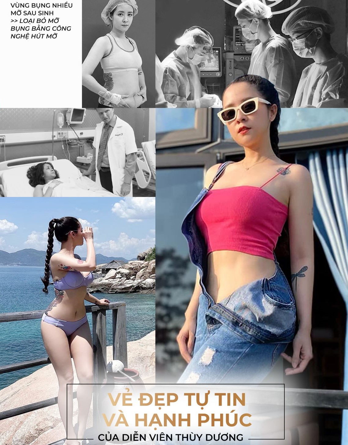 Loại bỏ mỡ bằng công nghệ hút mỡ