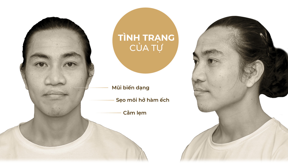 tình trạng của tự