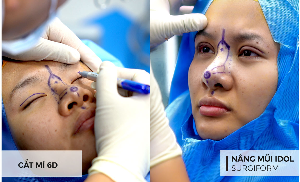 Bật mí Công thức Nâng cấp Diện mạo cho Xuân Ca