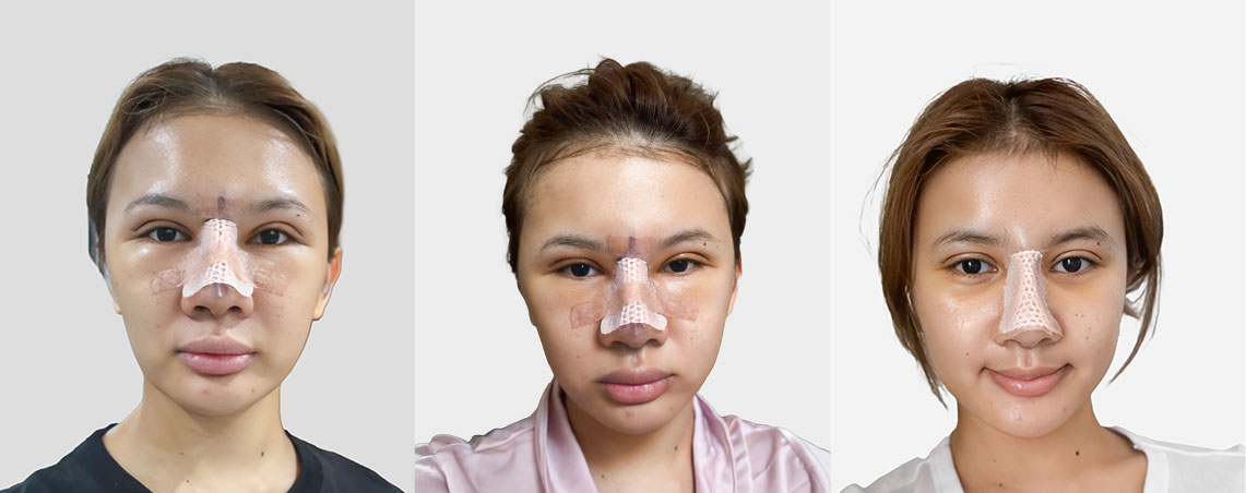 30 ngày "Đẹp ảo hóa Đẹp thật"