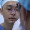 Giải cứu mũi cong vẹo hơn 10 năm cho bác sĩ trẻ