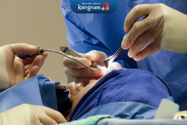 Hình ảnh một ca phẫu thuật chỉnh sửa mũi gồ, mũi lệch tại BV. Kangnam