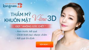 Thẩm mỹ khuôn mặt Vline 3D Hàn Quốc – Mặt đẹp tự nhiên