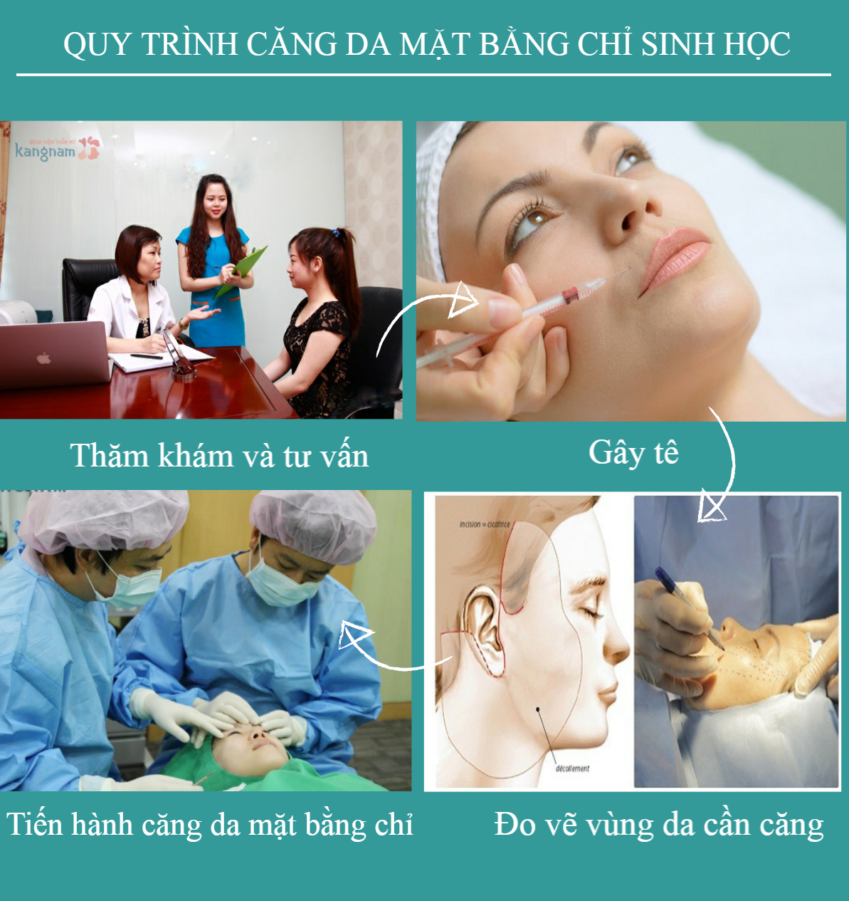 cang-da-mat