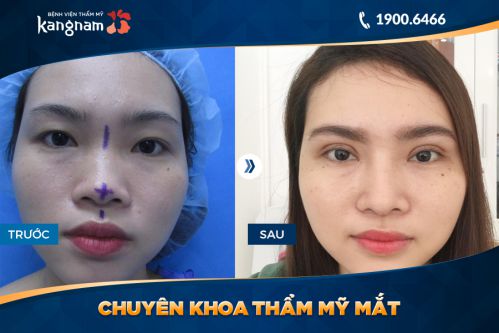 nang chan may 5