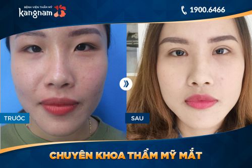 nang chan may 7