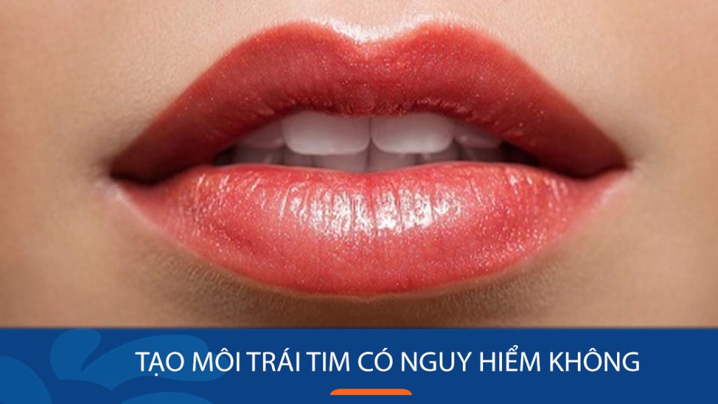 Tạo môi trái tim: Nguy cơ tiềm ẩn và những điều cần lưu ý