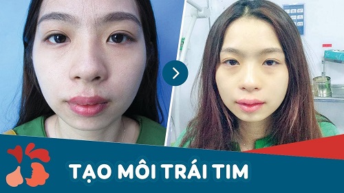 video cắt môi trái tim