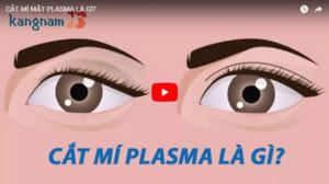 Cắt mí mắt Plasma là gì?- so sánh sự khác biệt so với các phương pháp thông thường