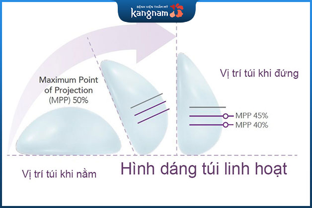 Nâng ngực Nano Chip linh hoạt dáng tròn và giọt nước theo tư thế cơ thể