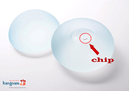 nâng ngực nano chip là gì