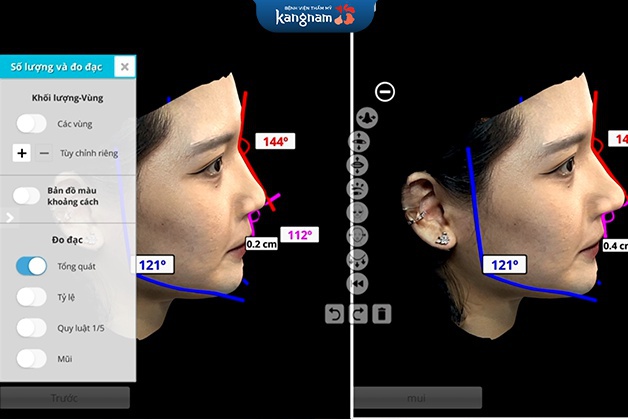 Thiết kế khuôn mặt bằng công nghệ AI - Face Design