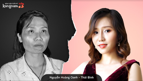 nguyễn hoàng oanh - hành trình lột xác 2018 2