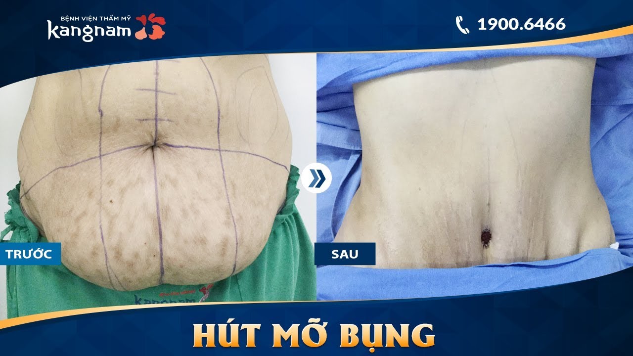 video giảm mỡ vòng 2