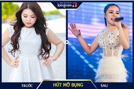 khách hàng hút mỡ