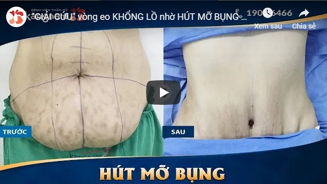 video Tạo hình Body S-line